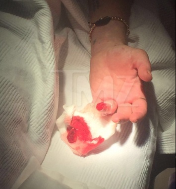 Известной актрисе Линдси Лохан оторвало палец! (ФОТО)