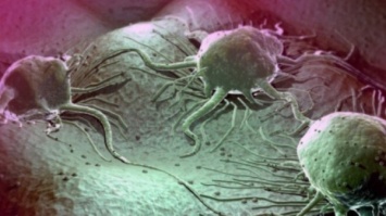 Ученые рассказали, как рак обманывает организм больного