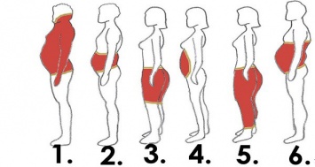 6 Типов ожирения в организме и как избавиться от него