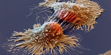 Ученые научились уничтожать раковые клетки с помощью витамина B2