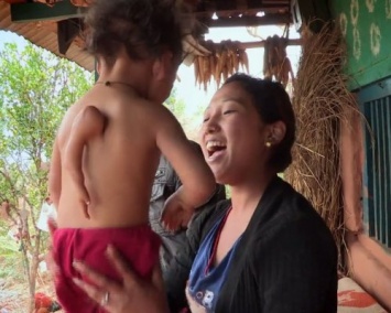 В Непале ребенок родился с третьей рукой на спине
