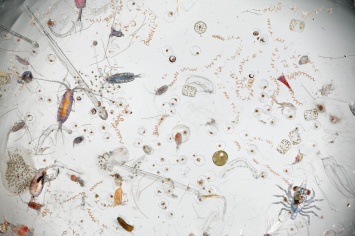 В Амстердаме покажут жизнь микробов под 3D-микроскопом