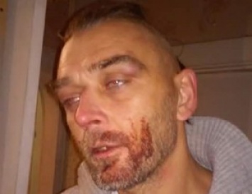 Патрульную полицию Николаева обвиняют в избиении десантника-АТОшника. Полиция оправдывается