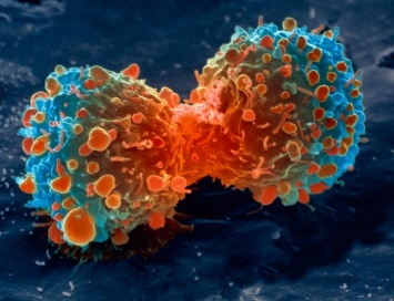 Ученые обнаружили аномалии в генах, не позволяющие лечить рак молочной железы