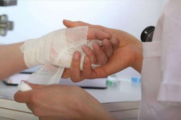 В Запорожской области постоялица гостиницы исполосовала себе руку