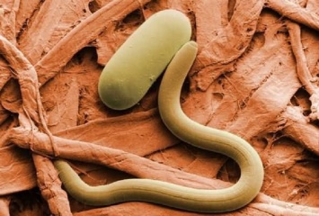 Врачи-паразитологи бьют тревогу! 95 % населения заражены паразитами