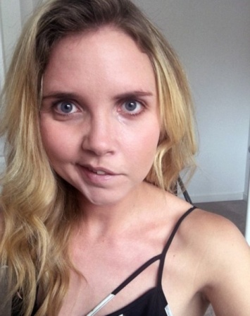 27-летняя девушка из Ноттингема смогла победить паралич Белла с помощью селфи