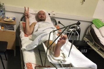 Известный российский журналист получил серьезную травму: фото из больницы