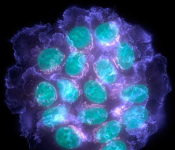 Метаболизм клеток рака молочной железы оказался митохондриальным
