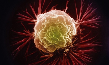 Ученые выявили особенности метаболизма клеток рака молочной железы
