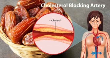 Может ли это быть продуктом питания № 1 в мире для профилактики приступов стенокардии, высокого артериального давления и холестерина?