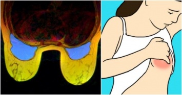 8 видов боли в груди, которые должны вас насторожить