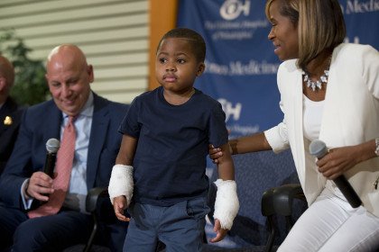 В США пересадили кисти рук восьмилетнему мальчику