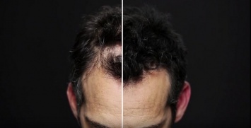 «Временные волосы»: спрей, который замаскирует лысину или плохую стрижку