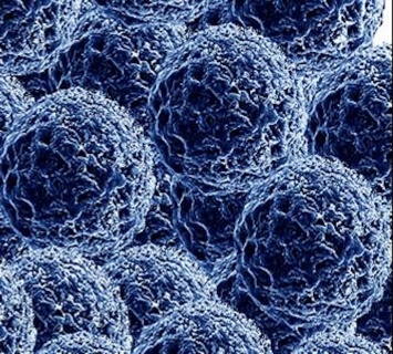 Ученые из России создали наночастицы, убивающие рак