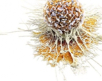 Ученые научились определять точные причины развития рака