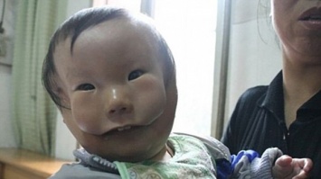 Интернет взбудоражили снимки двуликого китайского мальчика