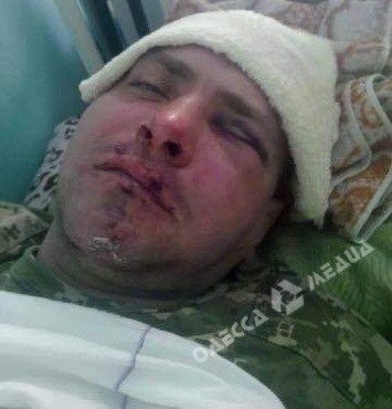 В Одесской области боец АТО попал в драку (фото)
