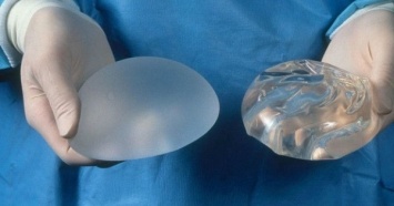 Французский суд обязал регулятора ФРГ выплатить 60 млн евро за некачественные грудные импланты