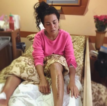 Настя Каменских показала ужасный шрам после операции на ноге