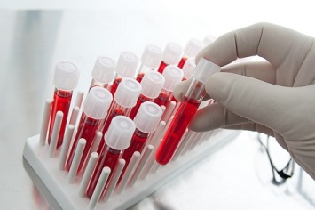 Ученые смогут диагностировать шизофрению по анализу крови