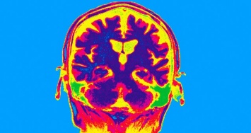 Ученые рассказали, почему мозг сохраняет только самые важные воспоминания