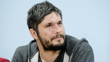 Медики Днепра сохранили зрение британскому фотографу, раненому в Авдеевке