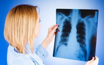 Врачи Днепропетровщины фиксируют заболеваемость туберкулезом