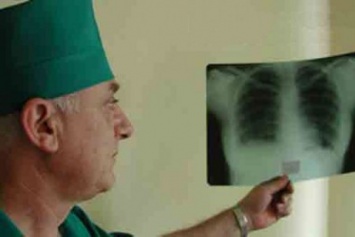 За минувший год 865 жителей Черниговской области заболело туберкулезом