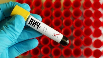 Инновационный препарат от ВИЧ разрабатывают в Белоруссии