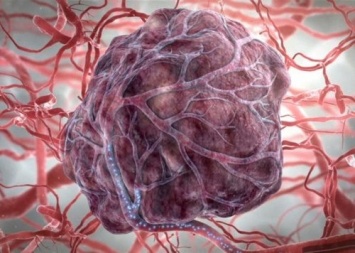 Ученые нашли способ состарить раковые опухоли