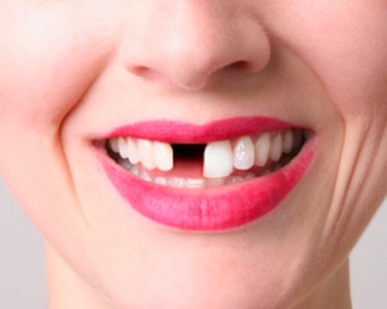 Ученые: Кокаин плохо влияет на зубы и десны