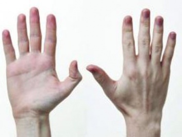 Здоровье человека: Что могут рассказать о Вас пальцы рук