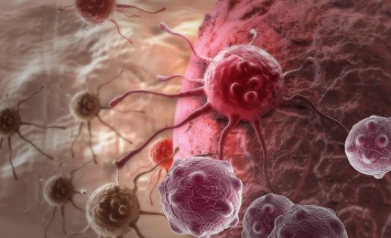 Ученые выяснили причины заболевания раком в 66% случаев
