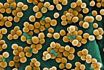 Низкая концентрация антибиотика усиливает сопротивление патогенных бактерий