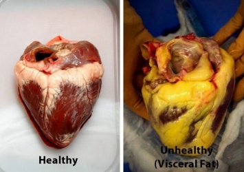Эти 10 продуктов очистят ваши артерии и предотвратят сердечный приступ!