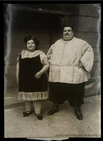 100 лет назад эта пара была самой толстой в мире. Вот как они выглядели!
