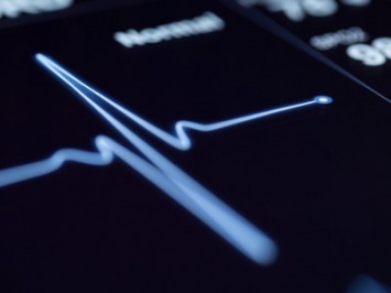 ИИ превзошел кардиологов по эффективности предсказания сердечного приступа
