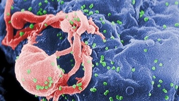 Российские биологи выяснили, почему ВИЧ иногда вызывает рак