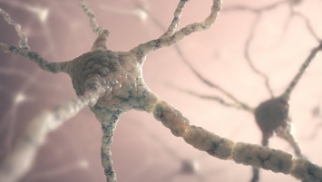 Биологи нашли возможную причину развития рассеянного склероза
