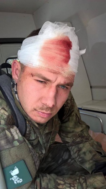 В Днепр Победы возле памятника Славы проломили голову герою АТО