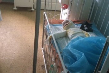 В Одессе годовалую девочку родители "обварили" в кипятке и 16 дней лечили дома (ФОТО)