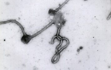 Вирус Эбола связали с рубцеванием сетчатки