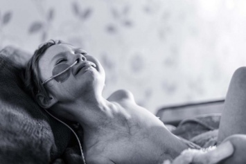 Настоящее лицо рака: фото 4-летней онкобольной девочки тронуло мир