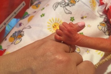 До слез: Одесский акушер написала самую трогательную историю о недоношенном малыше (ФОТО)