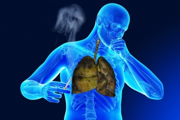 Легкие сигареты приводят к самой тяжкой форме рака - Ученые