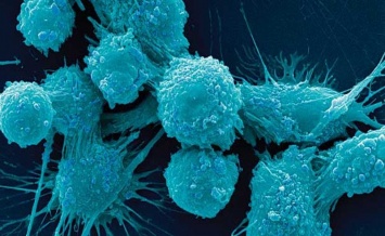 Ученые случайно нашли возможное лекарство от рака