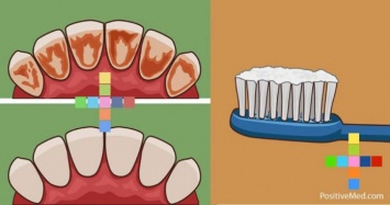 Как удалить зубной камень, очистить зубной налет и уничтожить бактерии с помощью всего только одного ингредиента!