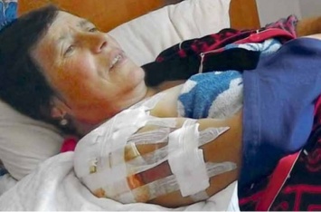 Мясо рвал кусками: депутатский волкодав напал на женщину
