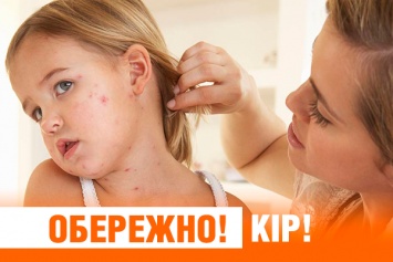 Эпидемия кори в Украине. Как не заболеть (ИНФОГРАФИКА)